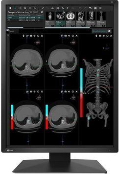 EIZO RadiForce MX217 ID-CN-157308 фото